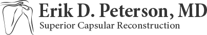 Superior Capsule Reconstruction